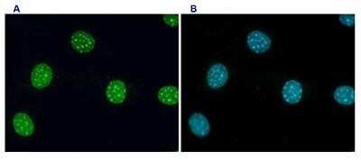 Immunofluorescence: Histone H3 [Trimethyl Lys9] Antibody [NBP2-59152] - NIH3T3 cells (mouse fibroblasts) were stained with the antibody against H3K9me3 and with DAPI. Cells were formaldehyde fixed, permeabilized with Triton X-100 and blocked with PBS containing 2.5% BSA. Figure A: cells were immunofluorescently labelled with the H3K9me3 antibody (diluted 1:200 and incubated for 1 hour at room temperature) followed by goat anti-rabbit antibody conjugated to FITC. Figure B: staining of the nuclei with DAPI, which specifically labels DNA. Both antibody and DAPI staining are restricted to the nucleus. The dense signals obtained with both stainings characterize the distribution pattern of H3K9me3, which is linked to the transcriptionally inactive, condensed pericentric heterochromatin.